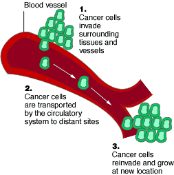 drawing showing how cancer cells can migrate