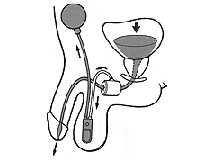 diagram showing the flow of the urine