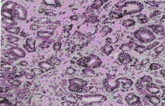 photo of pathology slide