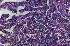 photo of pathology slide