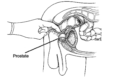 line drawing of a digital rectal examination