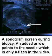 ultrasound screen taken from the video